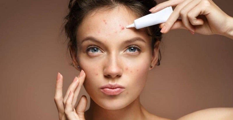Các sản phẩm đặc trị mụn