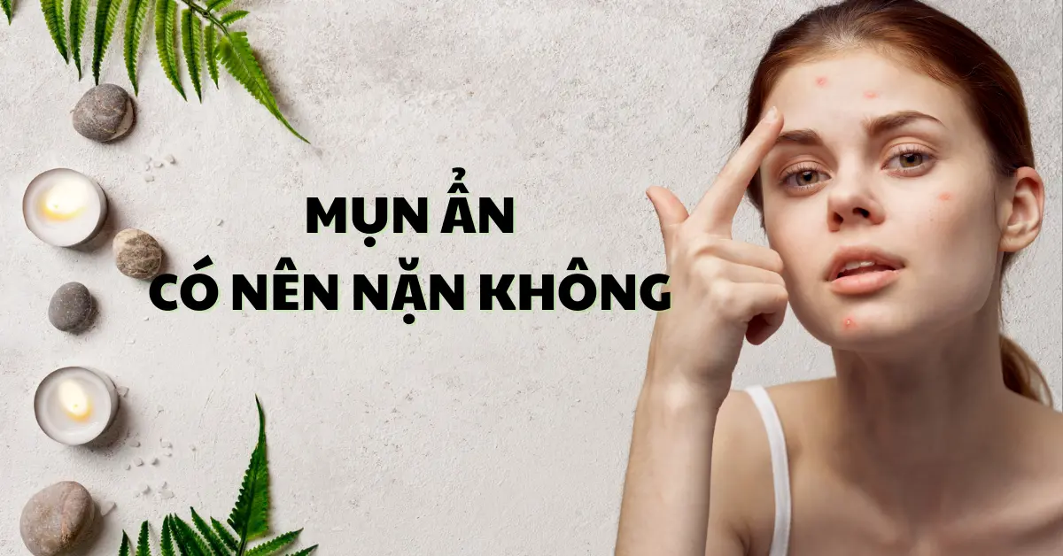 Mụn ẩn có nên nặn không? Mách bạn cách chăm sóc đúng cách