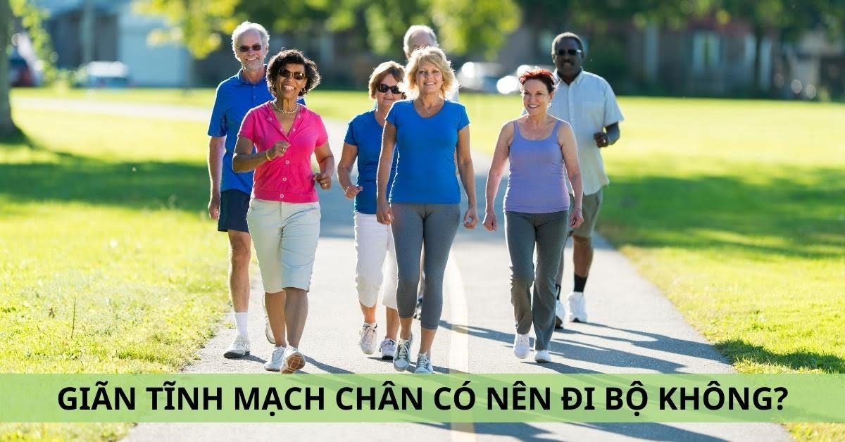 giãn tĩnh mạch chân có nên đi bộ không