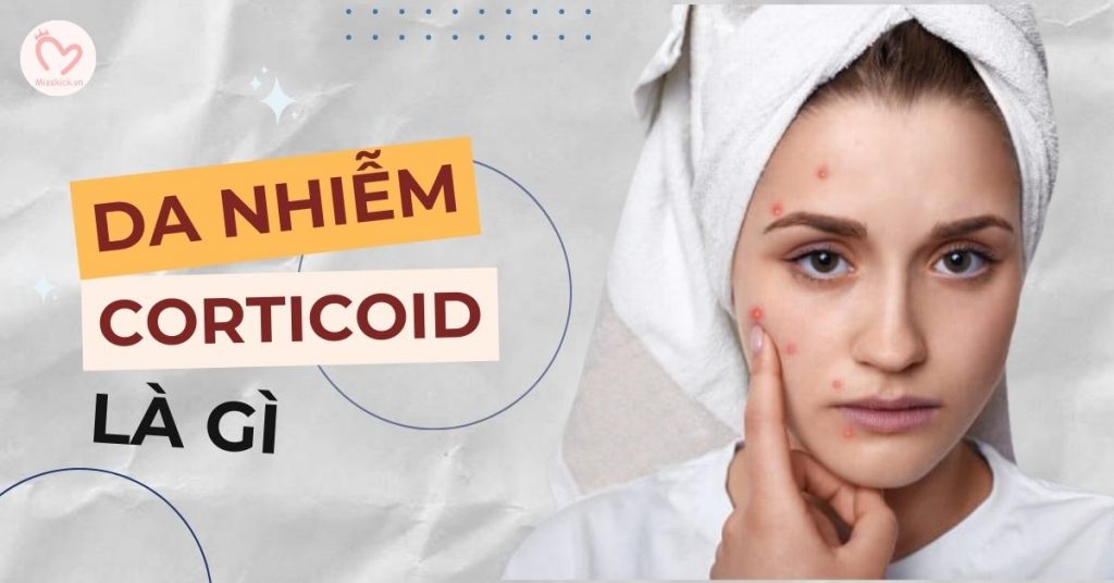 Da nhiễm corticoid
