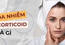 Da nhiễm corticoid