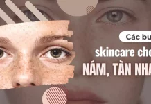 các bước skincare cho da nám, tàn nhang