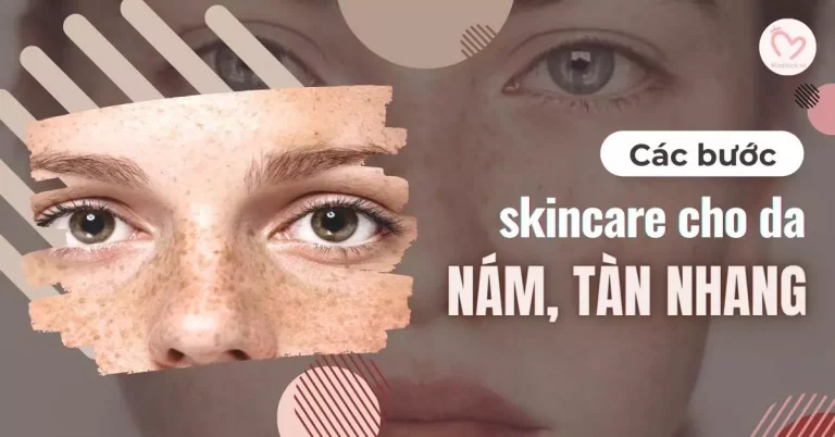 các bước skincare cho da nám, tàn nhang