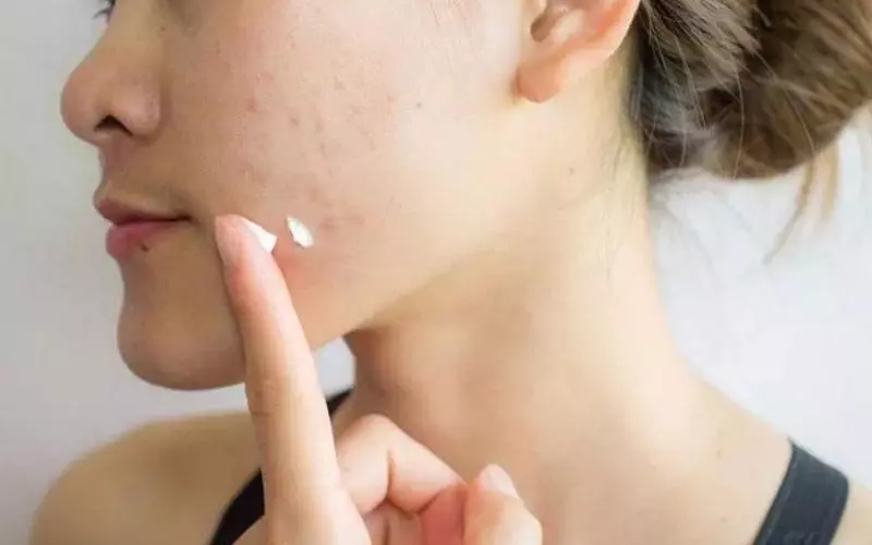 Các bạn nên sử dụng những phương pháp điều trị mụn, tàn nhang, thâm nám,... vào ban đêm